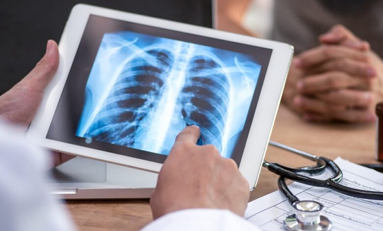 Tech Life - Artificial intelligence helps doctors detect lung cancer - BBC Sounds