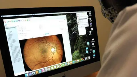 Getty Images An health work looks at a computer screen showing an image of a patients fundus.